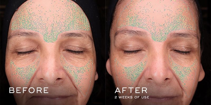 Press & Glow 2022 - Before & After 2 (Medium)