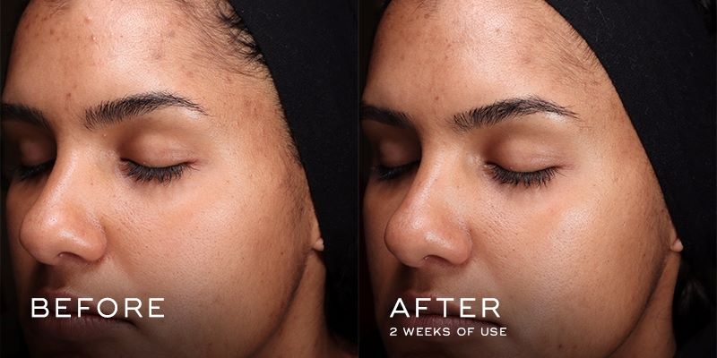 Press & Glow 2022 - Before & After 3 (Medium)