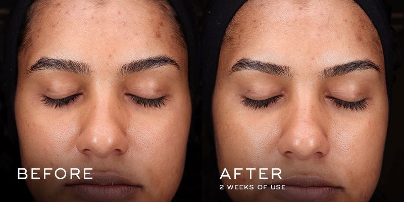 Press & Glow 2022 - Before & After 4 (Medium)