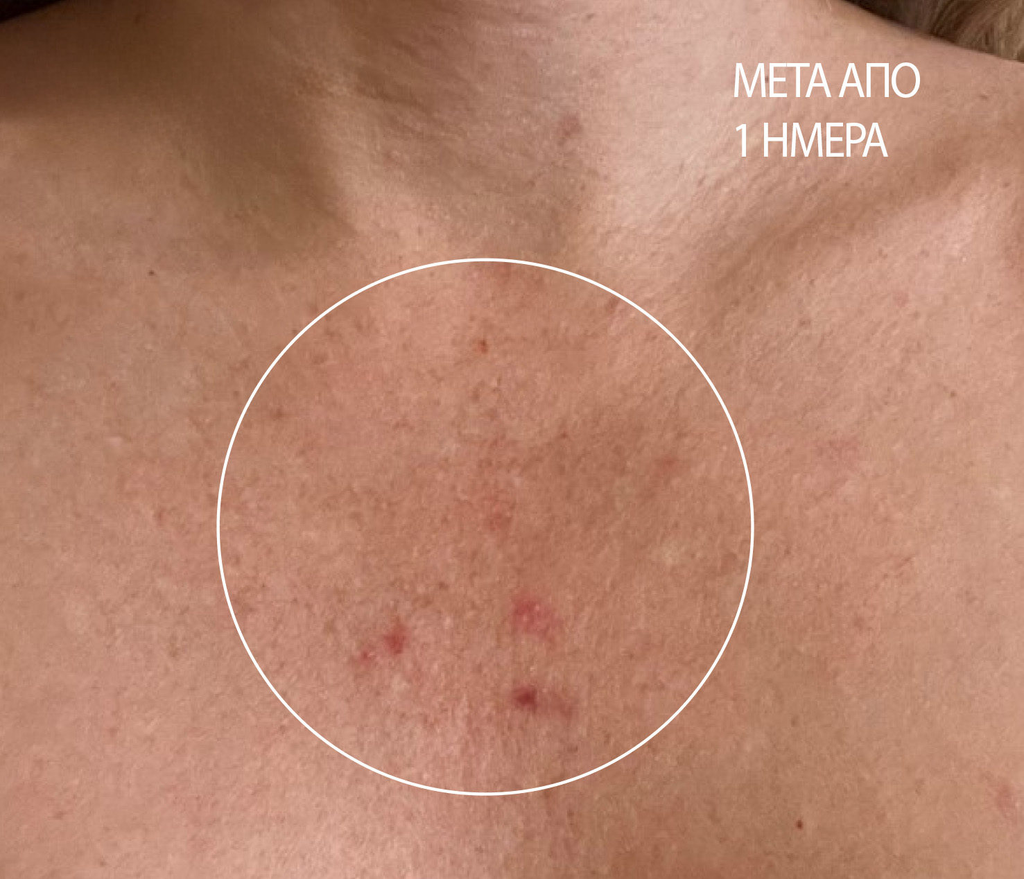 Retexturizing Body and Face Pads. Results after 1 day.